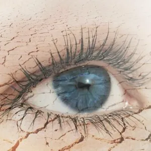 Dry Eye Treatment